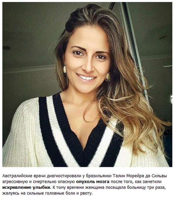 Як посмішка врятувала життя 30-річної бразильянке (4 фото)