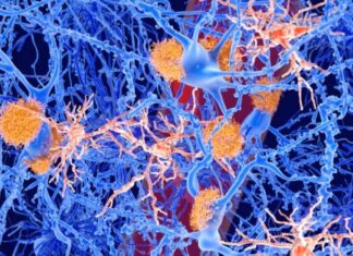 New Compound Shows Promise in Reversing Alzheimer’s Symptoms in Rats