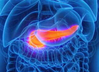 El modelo de IA detecta el cáncer de páncreas hasta dos años antes de que aparezcan los síntomas