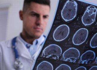 Come i disturbi del sonno modificano la struttura cerebrale: una meta-analisi